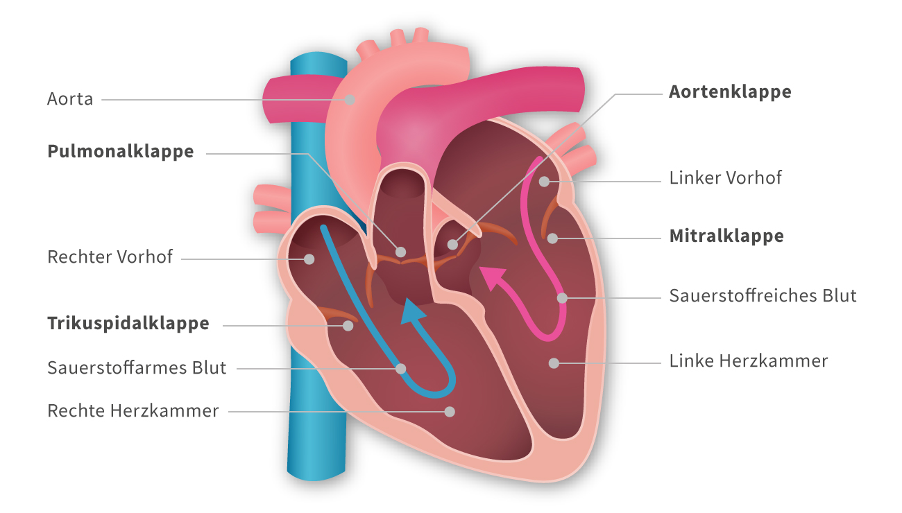 Eine Grafik die ein menschliches Herz mit allen vier Herzklappen darstellt. Außerdem sind die Vorhöfe sowie sauerstoffarmes sowie sauerstoffreiches Blut zu erkennen.